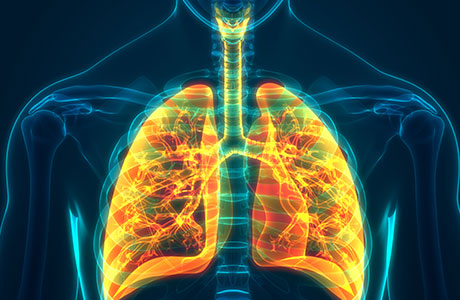 4 Steps for Managing a COPD Flare-Up